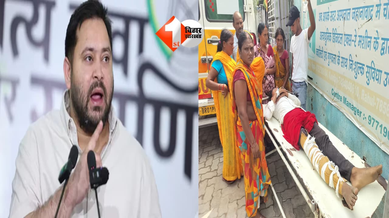 सरकार के पास फ्रैक्चर पर प्लास्टर लगाने तक के पैसे नहीं बचे? सरकारी अस्पताल में टूटे पैर पर कार्टन बांधने पर भड़के तेजस्वी